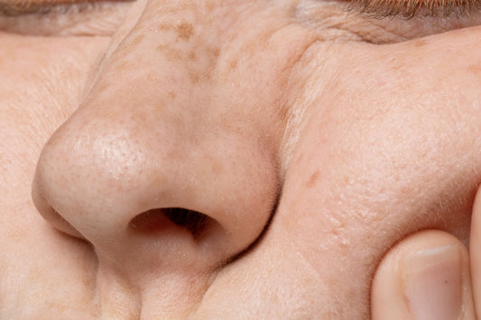Best Serum To Remove Open Pores