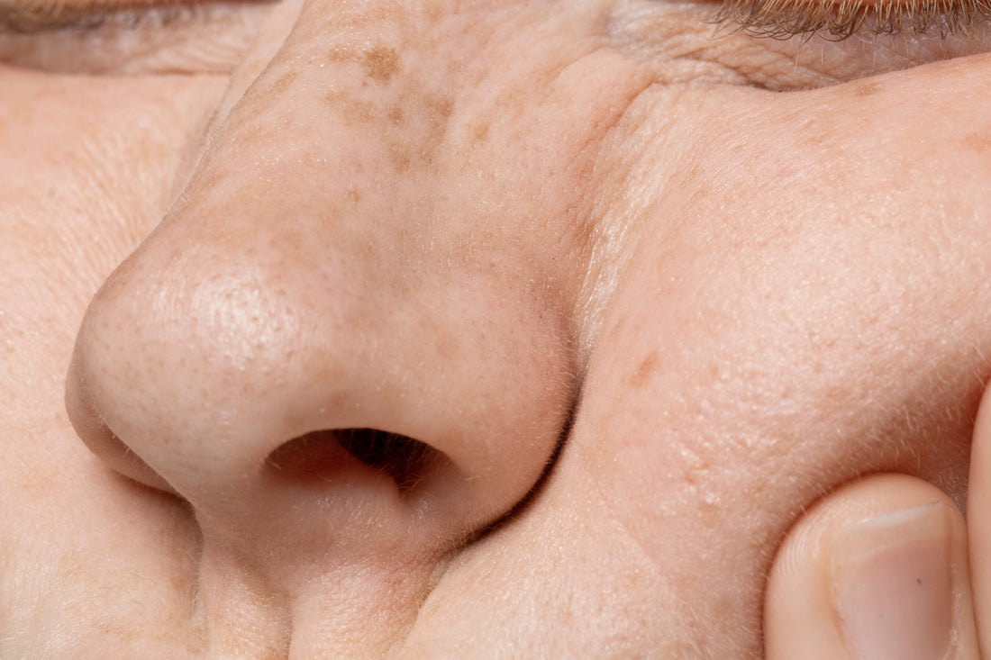 Best Serum To Remove Open Pores
