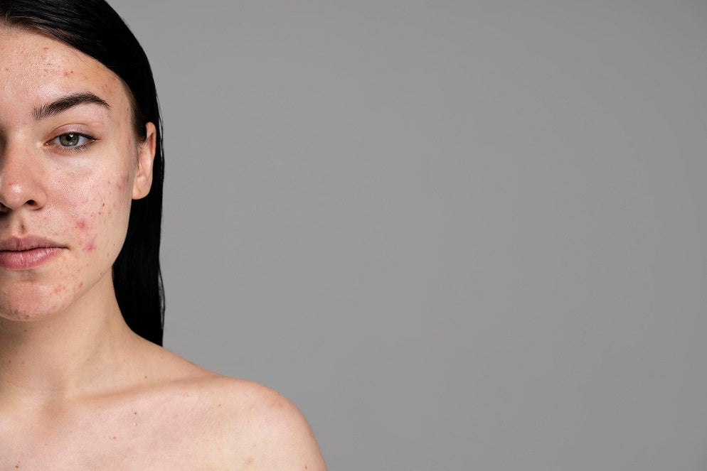 The Secret To Remove Dark Spots And Improves The Skin Texture