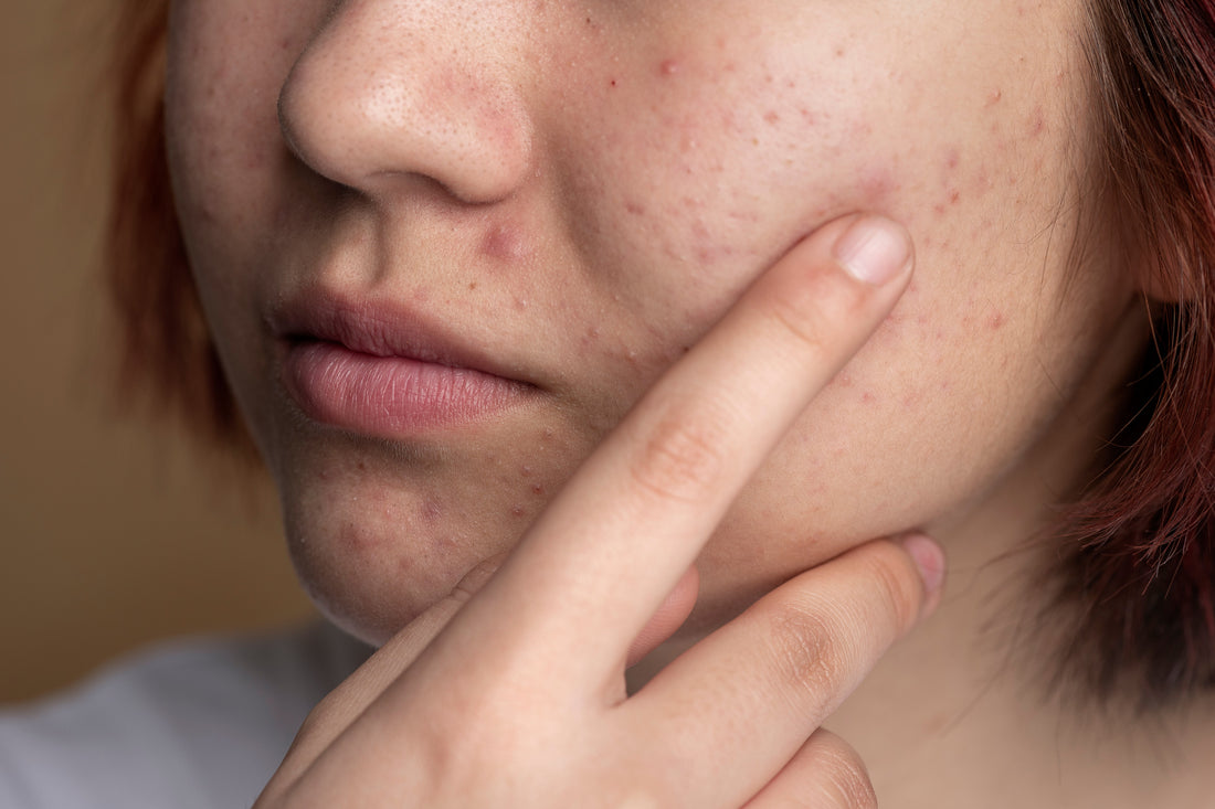 The Secret to Healthy, Glowing Skin_ Gluta White Collagen Serum