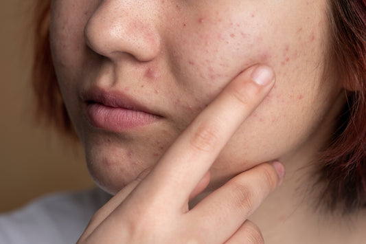 The Secret to Healthy, Glowing Skin_ Gluta White Collagen Serum