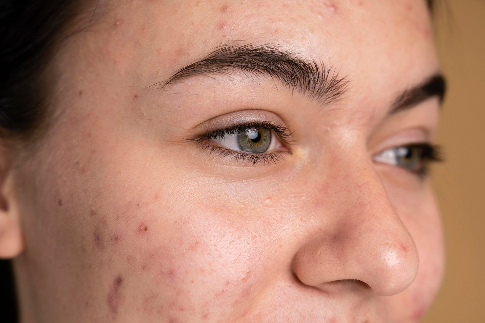 Your New Secret to Clear, Glowing Skin: Gluta White Anti Pigmentation Serum